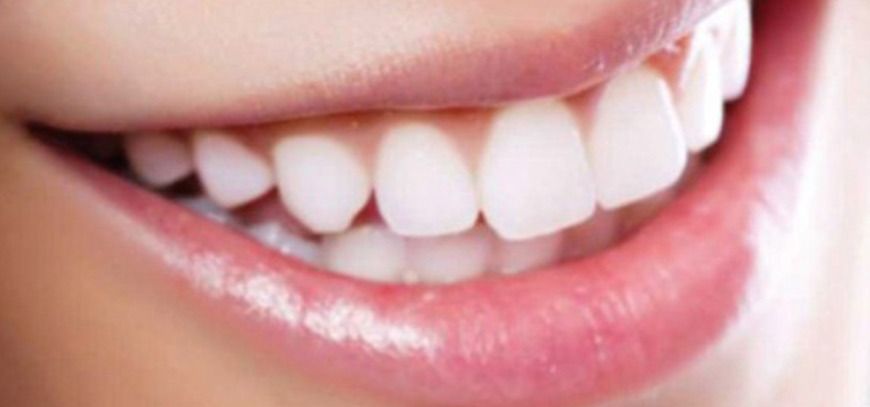 Periodontoloji